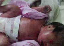 扬州三代试管婴儿生孩子要花多少钱？附三代试管婴儿收费参考